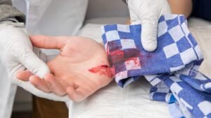 Bleeding Control