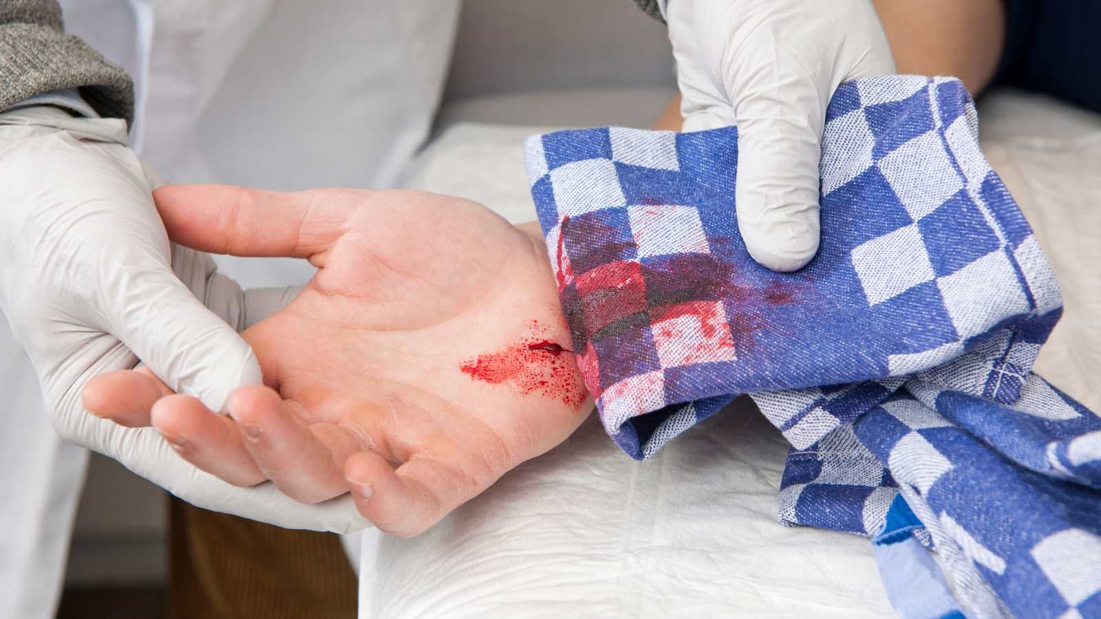 Bleeding Control