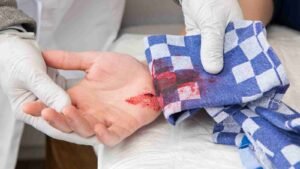 Bleeding Control